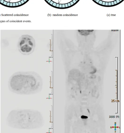 Fig. 7. (Color online) Whole-body FDG study.