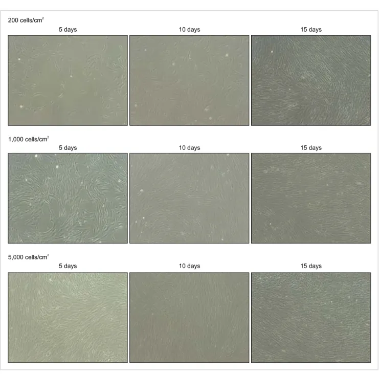 Fig. 2. Phase-contrast micrograph of BM-MSCs obtained from 5-, 10-, and 15-day cultures after seeding at a density of 200, 1,000, and 5,000  cells/cm 2  (×40)