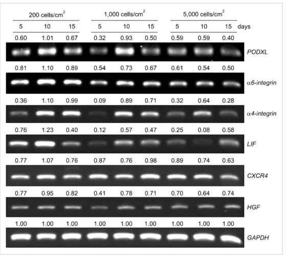Fig. 4. RT-PCR analysis of MSCs  after seeding at different densities  and culturing for varying times