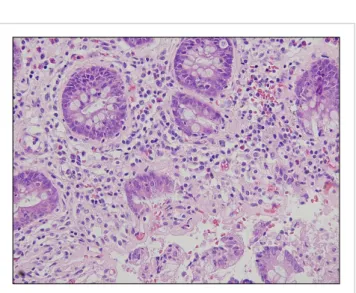 Fig. 4. Pathological images are consistent with chronic GVHD (H&amp;E  staining).