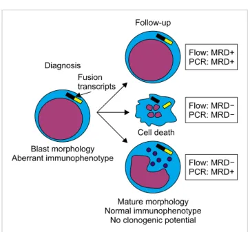 Fig. 3. Possible scenarios that may explain concordant or discordant  MRD results by flow cytometry and PCR after chemotherapy