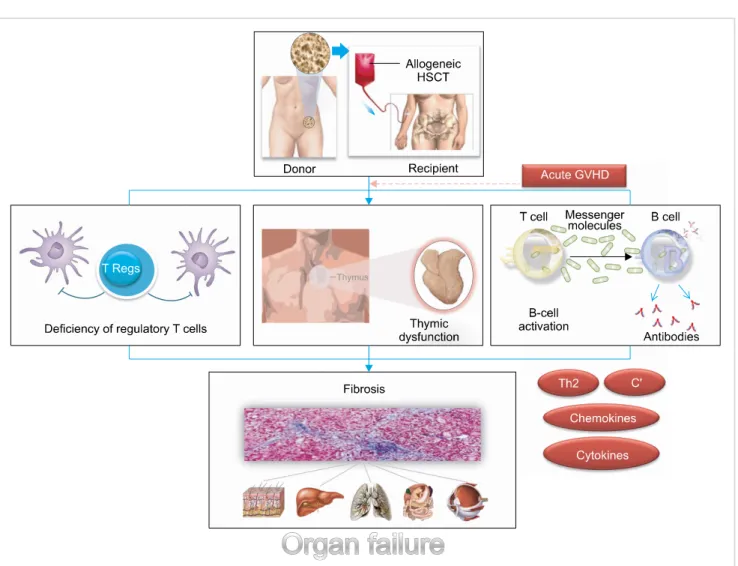 Fig. 1. The pathophysiology of chronic graft-versus-host disease.
