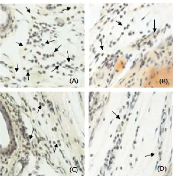 Fig.  5.  Inhibitory  effect  of  PEM381  on  eosinophils  infiltra ⁃
