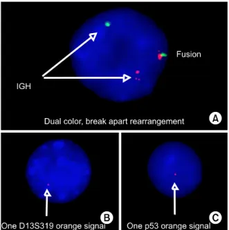 Fig. 1. Interphase fluorescence in situ hybridization (FISH) findings. (A) A plasma cell shows rearrangement of IGH