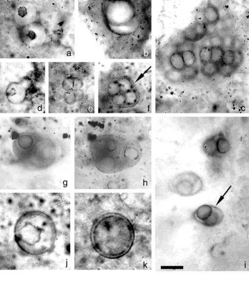 Fig. 3. Coccoid microfossils from the  Sukhaya Tunguska cherty  stromato-lites. For all fossils slide number and  coordinate number are given