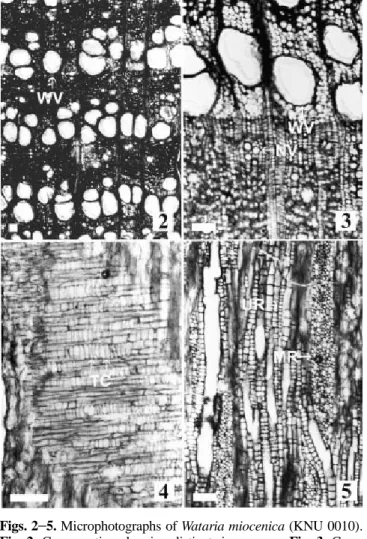 Fig. 6. Cross section showing distinct ring porous. Fig. 7. Radial section showing tile cells and procumbent cells