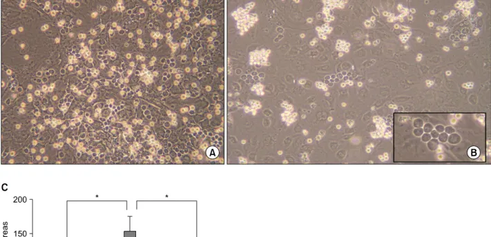Fig. 5. SDF-1 induces both the migration of myeloma cells beneath the stromal cells and the formation of cobblestone areas.