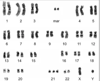 Fig. 2. Cytogenetic analysis was performed using leukemic blasts in the CSF analysis and chromosomal abnormalities of t(16;16)(p13.1;q22), +21, +2mar were noted.