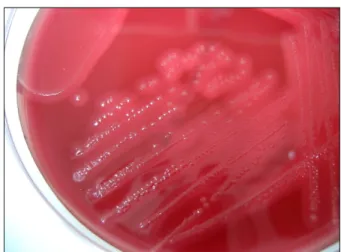 Fig. 4. Gram stain showed gram positive bacilli (×1,000). Fig. 5.  Blood  agar  plate  showed  double  zone  of  beta  he- he-molysis