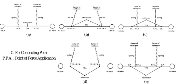 Fig. 5 Schematic diagrams of lingual orthodontic model for finite element analysis: (a) reference model; (b) model