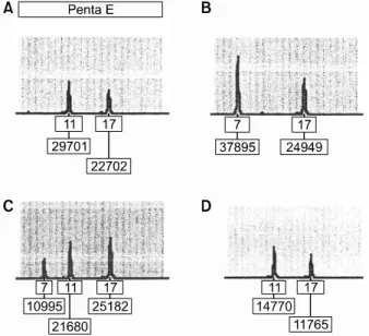 Fig. 1. Representative engraftment analysis results from the case No. 2 patient. The loci shown is penta E