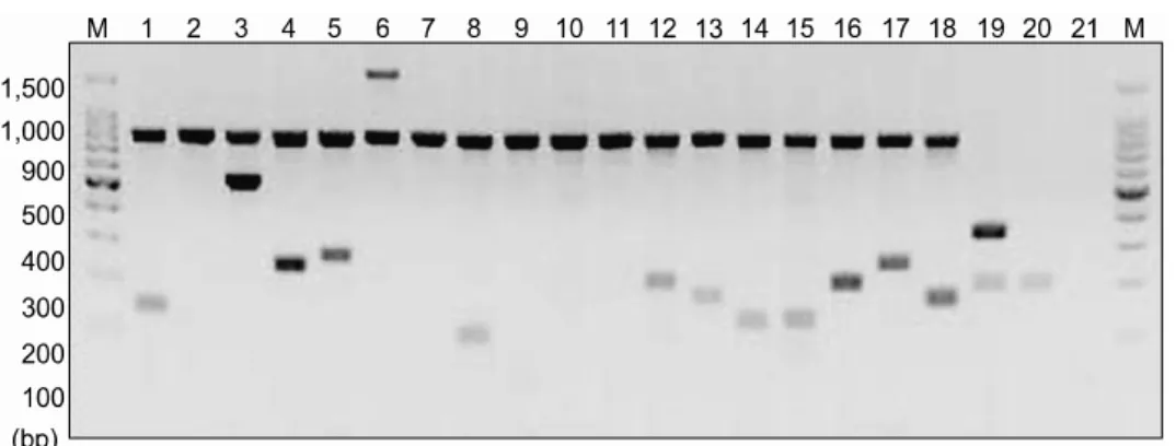 Fig. 1. KIR genotyping by PCR-SSP in a specific AML patient. Details are described in ‘Materials and Methods’.