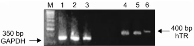 Fig. 4. Inhibition of mRNA expression of hTR. In the siRNA- siRNA-hTR143 transfected ES, mRNA expression of hTR was  decreased compared to control ES and siRNA-hTR143m transfected ES.