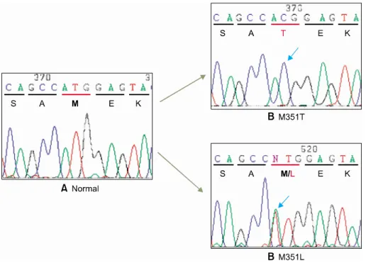 Fig. 3. Sequence analysis of BCR-ABL kinase dom ain. Norm al ABL gene (NM _005157)  has ATG sequence coding for m ethionine (M ) at codon 351 (A)