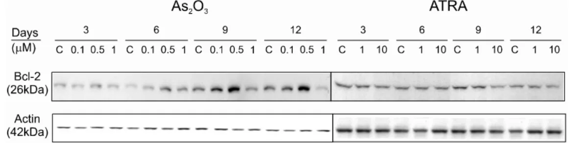 Fig. 4. Expression of Bcl-2 in K562 cells after treatm ent with As 2 O 3  or ATRA. The expression of Bcl-2 was increased in a tim e and dose dependent fashion in K562 cells treated with 0.1μM   or  0.5μM   of As 2 O 3  but abruptly decreased in K562 cells 