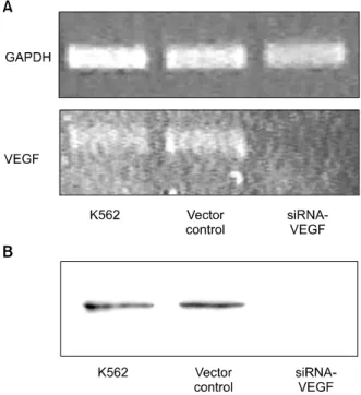 Fig. 1. Vascular endothelial growth factor (VEGF) expression in K562 cells. Control or siRNA to VEGF was transfected into K562 cells