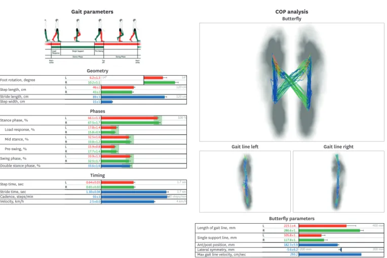 Fig. 1. Gait parameter analysis from a patient.