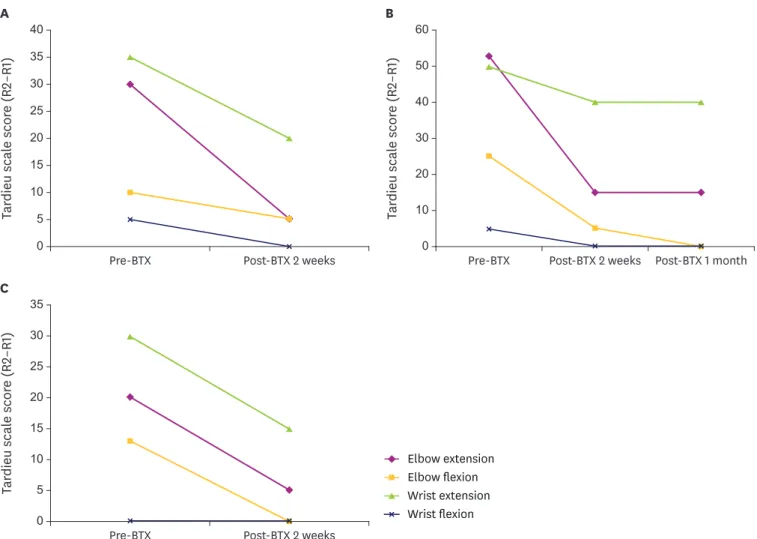 Fig. 2. The changes in the Tardieu Scale (R2–R1) after botulinum toxin injection: (A) after the first injection; (B) after the second injection; (C) after the third injection