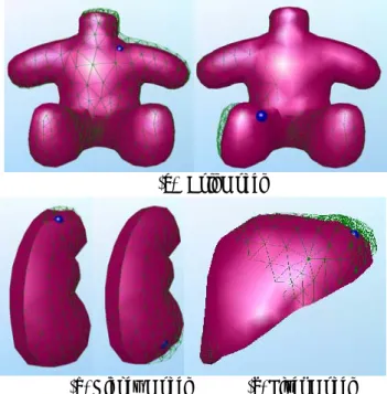 Fig. 3 Tetrahedron element and surface element  유한요소  해석을  수행하기  전에  변형체에  대한  RBVP 의  경계조건을  설정한다