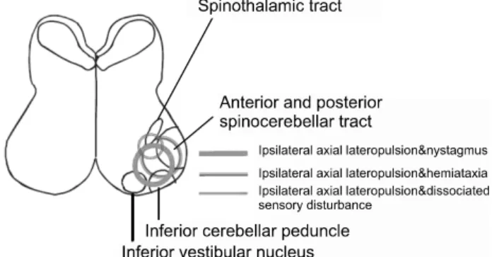 Fig. 5. The anatomical structures correlated of balance problem in the dorso- dorso-lateral medulla oblongata syndrome.