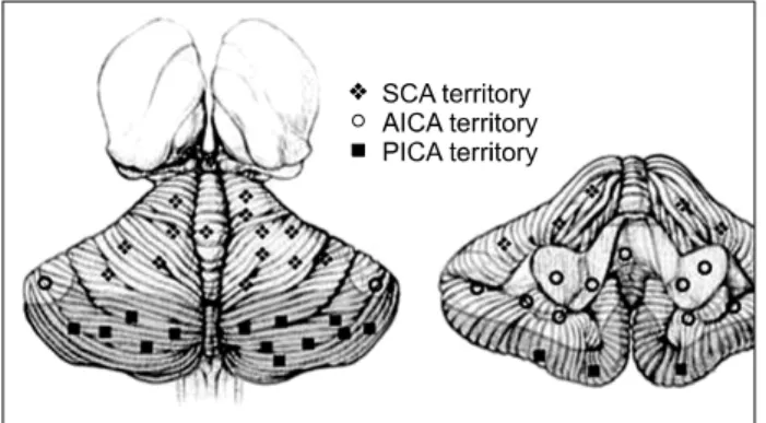 Fig.  6.  Schematic  drawing  showing  the  vascular  territories  of  the  cerebellum  (modified  from  Lundy-Ekman  2012).