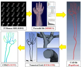 Fig. 1 Creation of 3D upper-extremity artery model  and numerical grid system from MRA  images 완성하여,  주요 장기로의 혈관 분지에 의한 맥파 의  파형과  위상변화의  분석을  통해  맥진의  과학 적 근거를 밝히는 큰 연구로 나아가고자 한다