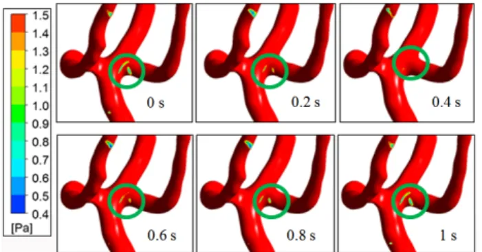 Fig. 8 Wall shear stress distribution at branch A  during 1 period