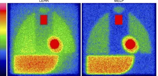 Fig. 2 shows images of the calibration phantom. The dif- dif-ference in image quality is significant between LE  high-res-olution and ME low-penetration (MELP) collimators
