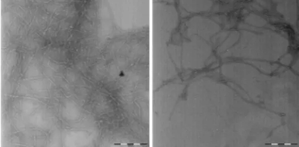 Fig.  1.  Transmission  electron  microscopy  image  of  nanocellulose  (scale  bar: 