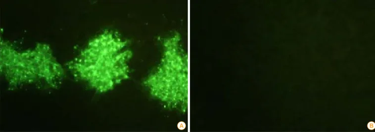 Fig. 3. Immunofluorescence (200×) of the ERAGS strain using an indirect fluorescent 