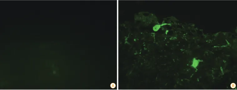Fig. 2. Identification of the rabies viruses (RABV) antigen using fluorescent antibody tests in brain samples obtained from sows inoculated with  the ERAGS strain