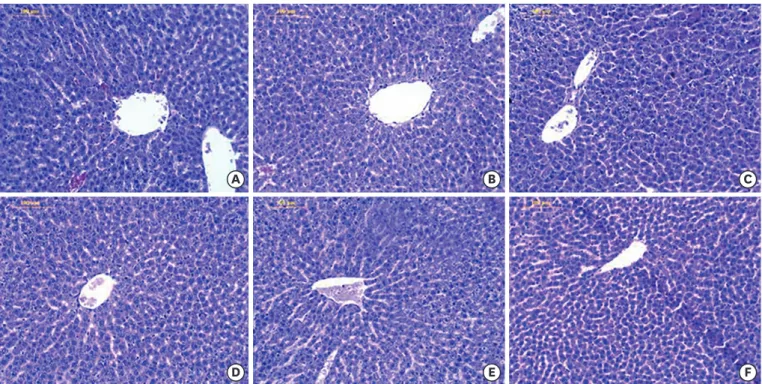 Figure 1. Effect of EAG on liver histology in PO-induced hyperuricemic rats. (A) Normal group, (B) hyperuricemia group induced by PO (250 mg/kg b.w.), (C) allopurinol  (50 mg/kg b.w.) + PO, (D) EAG (50 mg/kg b.w.) + PO, (E) EAG (100 mg/kg b.w.) + PO, (F) E