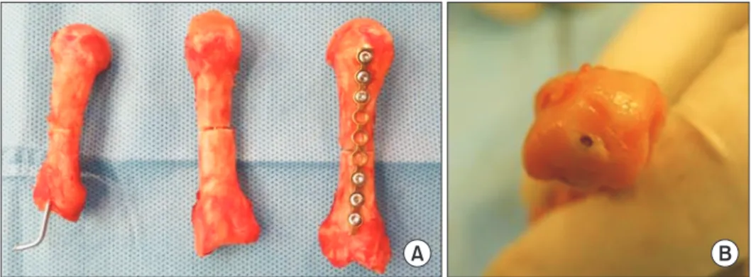 Fig. 2. (A) Three metacarpal shaft  fractures of the cadaver bones fixed with  the Kirschner wire (K-wire), headless  compression screw, or plate fixation  (from left to right)