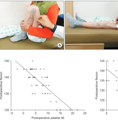 Fig. 3. Measurement of self-passive  flexion (A) and extension (B) angles of the  knee