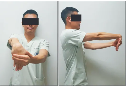 Fig. 5. Photographs showing the most  effective eccentric stretching position of  the extensor carpi radialis brevis.