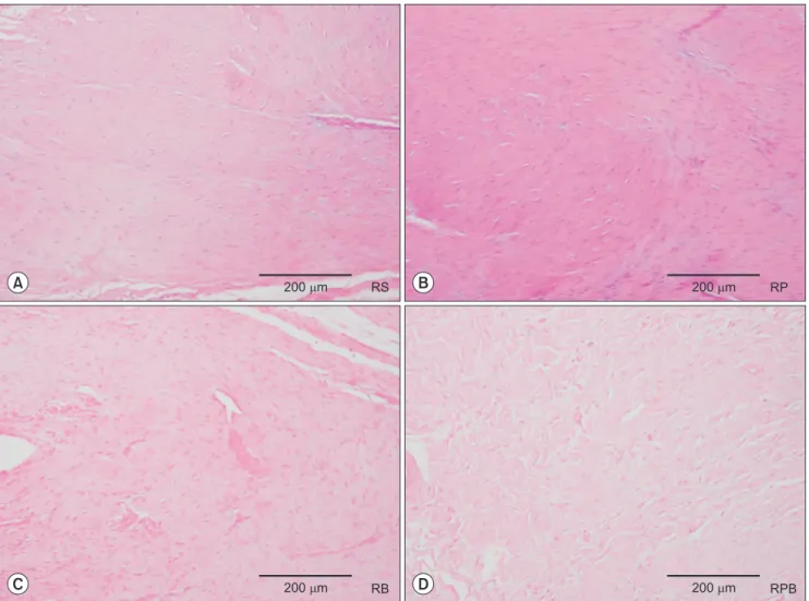 Fig. 6. Tendon-to-bone interface H&amp;E staining shows increased cellular and vascular fibrous tissues in the four groups: (A) repair + saline (RS) group, (B)  repair + platelet-rich plasma (RP) group, (C) repair + bone marrow aspirate concentrate (RB) gr