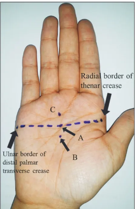 Fig. 3. (A) Location A. (B) Location B. (C) Location C. The distance from the metacarpal head to the distal end of the splint (a) and the whole length of the  metacarpal bone (b) were measured for every metacarpal bone except for the thumb on the wrist ant