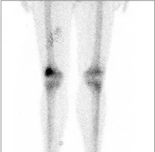 Fig. 2. Axial (A) and sagittal (B) computed  tomography images showing a 5 mm 