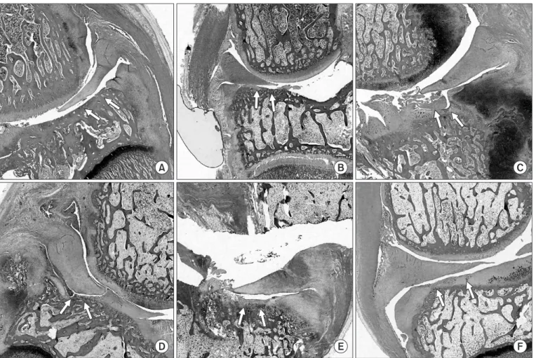 Fig. 3. Th e pathologic features were observed using optical microscope. Attachment between the undersurface of medial meniscus and tibial plateau  was not identifi ed in all cases