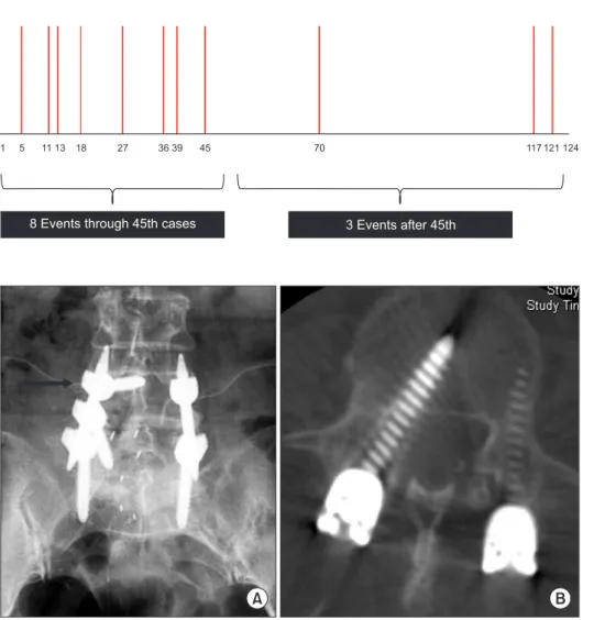 Fig. 1. Eight complications occurred in  the first one-third of the series (patients 