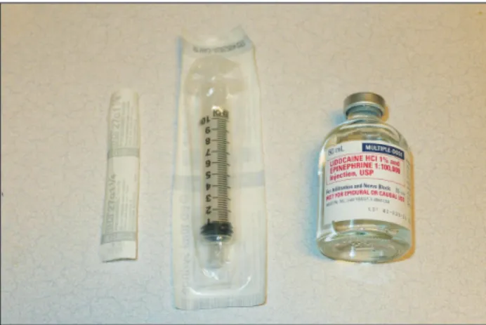 Fig. 2. Wide-awake local anesthesia for a  case with a complete zone 2 flexor tendon  cut in the middle finger