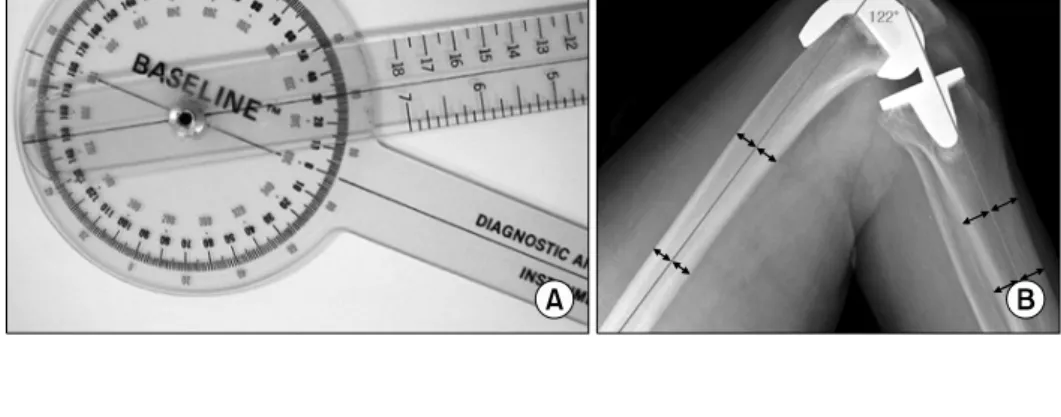 Fig. 2. Estimation of the fle- fle-xion angle of the knee and the angle  measured  using  a   stan-dard  2-arm  Goniometer  (12-  inch arms with 1 o  markings)  (A)