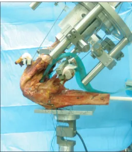 Fig. 6. Testing setup for quantifying the tibiofemoral contact and  kinematics with kneeling