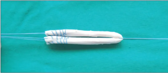 Fig. 1. Graft preparation. 