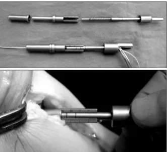 Fig. 13. Isometer, specially designed device for the measure- measure-ment of isometricity