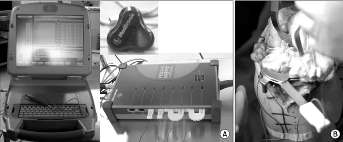 Fig. 2. Optical navigation system. (A) Appearance, (B, C) Monitor.