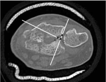 Fig. 2. Sagittal computed tomography image of the radiocarpal joint. 