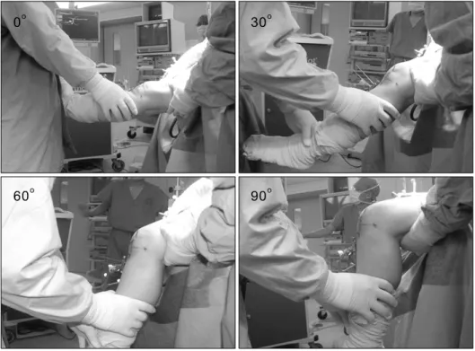 Fig. 2. Acquisition of leg data in  0,  30,  60  and  90  degrees  of  flexion position respectively.