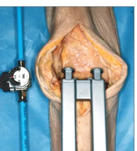 Table 1. Interobserver Agreement of Gap Measurement by 3 Surgeons