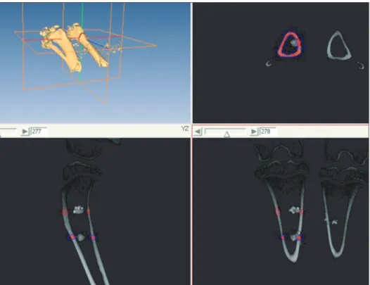 Fig. 3. Computer tomographic analysis  (Display options; Min-1213, Max-5766).